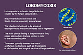 Lobomycosis fungal infection, illustration