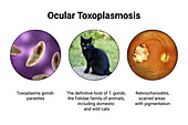 Ocular toxoplasmosis, an illustration