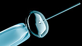 In vitro fertilisation, illustration