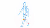 Joint pain while walking, illustration