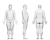 Overweight male body, illustration