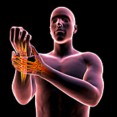 Wrist pain, illustration