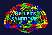 Heller's syndrome, conceptual illustration