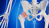 Male hip joint, illustration