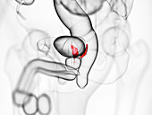 Seminal vesicles, illustration