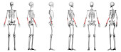 Radius bone, illustration