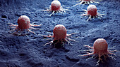 Cancer cell, illustration
