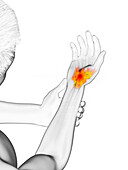 Man with a painful wrist, illustration