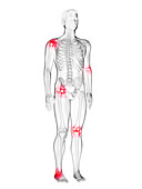 Man's painful joints, illustration