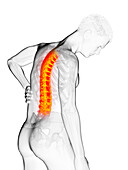 Man's painful back, illustration