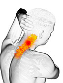 Man with a painful neck, illustration
