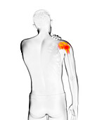 Man with a painful shoulder, illustration