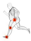 Obese runner's painful joints, illustration