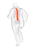 Obese runner's painful back, illustration