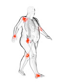 Obese man's painful joints, illustration