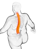 Obese man's painful back, illustration