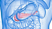 Inflamed pancreas, illustration