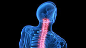 Painful upper spine, illustration