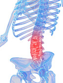 Male lumbar spine, illustration