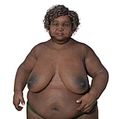 Overweight woman, illustration