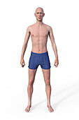 Male ectomorph body type, illustration