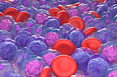 Acute myeloid leukemia, illustration