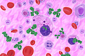 Multiple myeloma cell emitting paraprotein, illustration