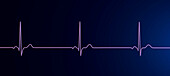 Sinus bradycardia heartbeat rhythm, illustration