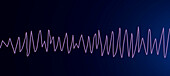 Torsades de pointes heartbeat rhythm, illustration