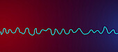 Ventricular fibrillation heartbeat rhythm, illustration