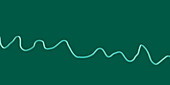 Ventricular fibrillation heartbeat rhythm, illustration