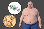 Overweight man with adipocytes and cholesterol, illustration