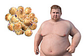 Overweight man with adipocytes, illustration