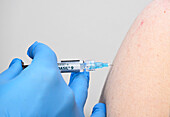 Patient receiving Gardasil cervical cancer vaccine