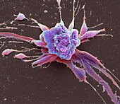 Chemotherapy induced cell death, SEM