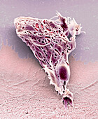 Chemotherapy induced cell death, SEM