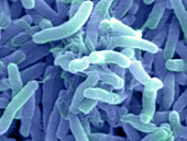 Vibrio cholerae bacteria, SEM