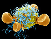 Respiratory Syncytial Virus, SEM