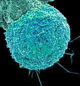 Respiratory Syncytial Virus, SEM