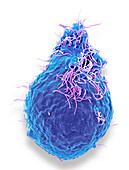 Respiratory Syncytial Virus, SEM