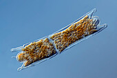 Odontella algae, light micrograph