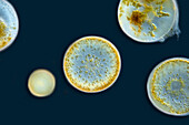 Coscinodiscus algae, light micrograph