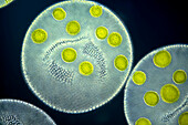Volvox globator algae, light micrograph