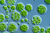 Chaetosphaeridium algae, light micrograph