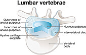 Healthy lumbar vertebrae and intervertebral disc, illustration
