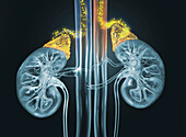 Human kidney, illustration