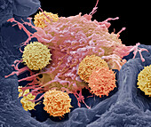 (CAR) T-cell therapy, SEM