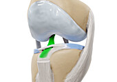 Anterior cruciate ligament without patella, illustration