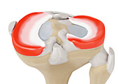 Zones blood flow meniscus, illustration