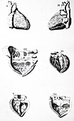 Plate of the heart, illustration